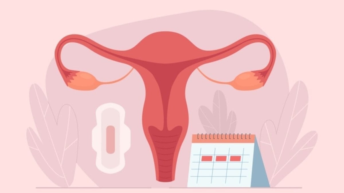 7 perguntas e respostas sobre adenomiose 7 perguntas e respostas sobre adenomiose