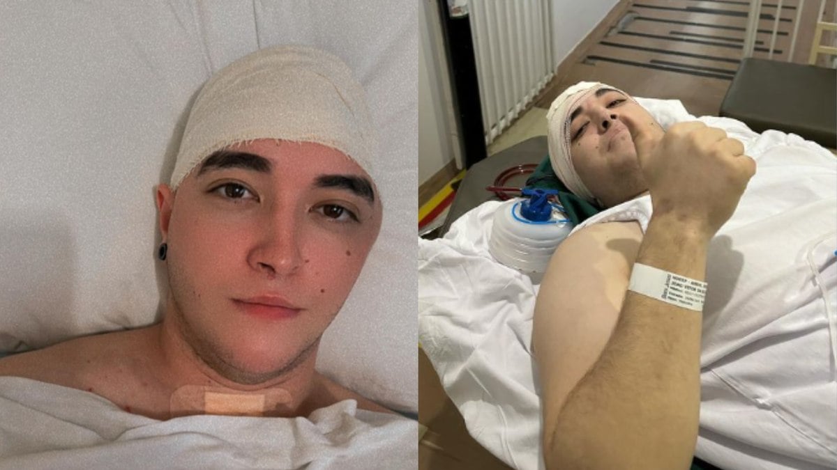 Influencer “guarda” osso da cabeça na barriga após acidente; entenda Influencer “guarda” osso da cabeça na barriga após acidente; entenda