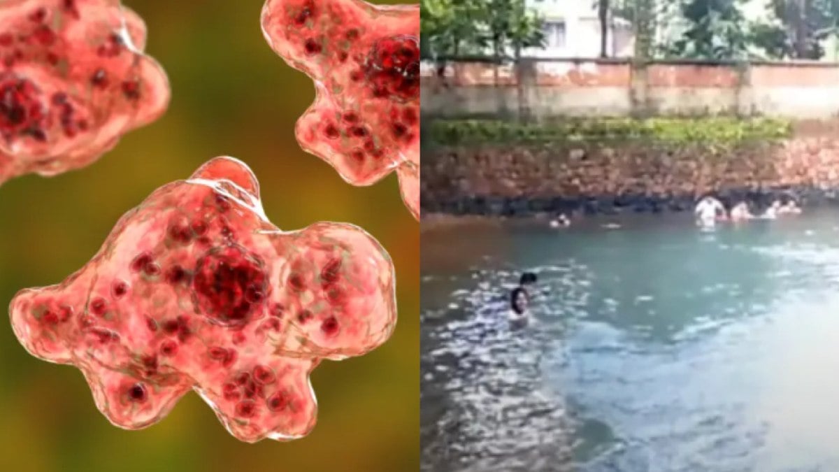 Ameba comedora de cérebro mata menino que nadou em água contaminada Ameba comedora de cérebro mata menino que nadou em água contaminada