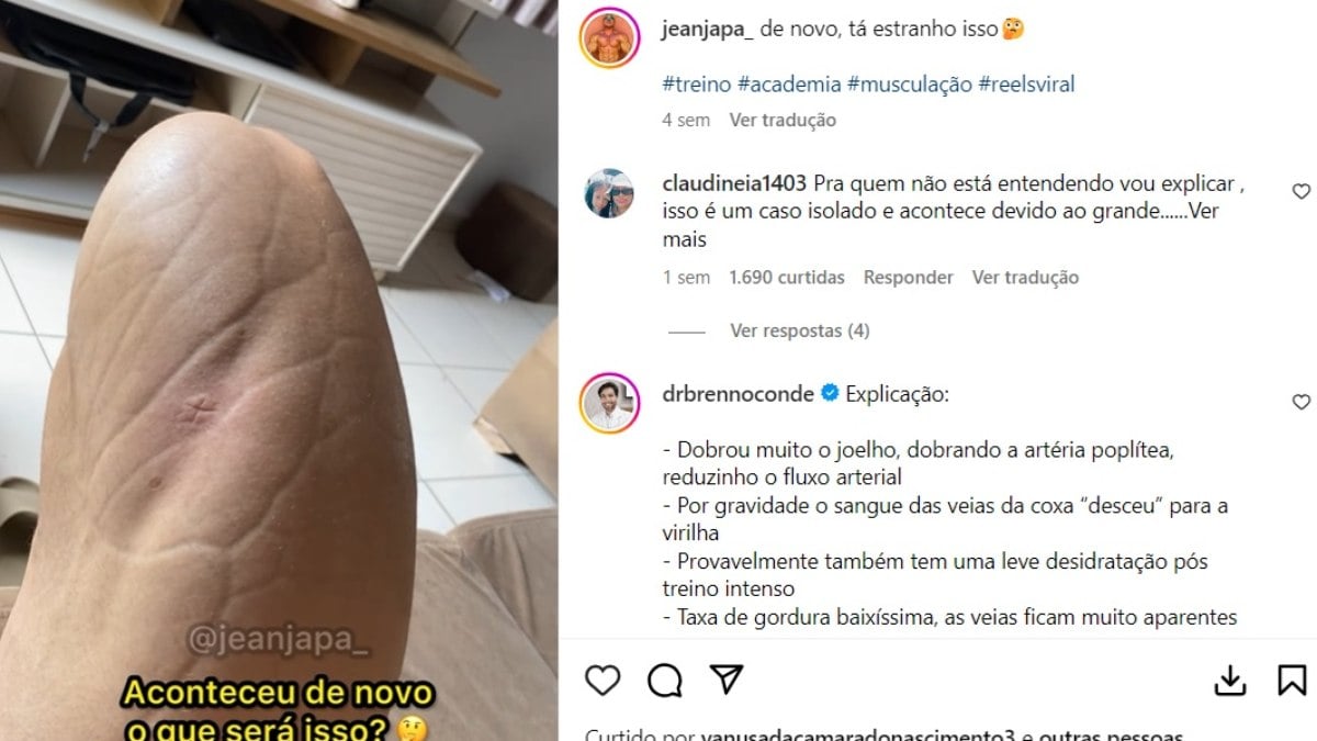 Bodybuilder impressiona seguidores com vídeo da perna; assista Bodybuilder impressiona seguidores com vídeo da perna; assista