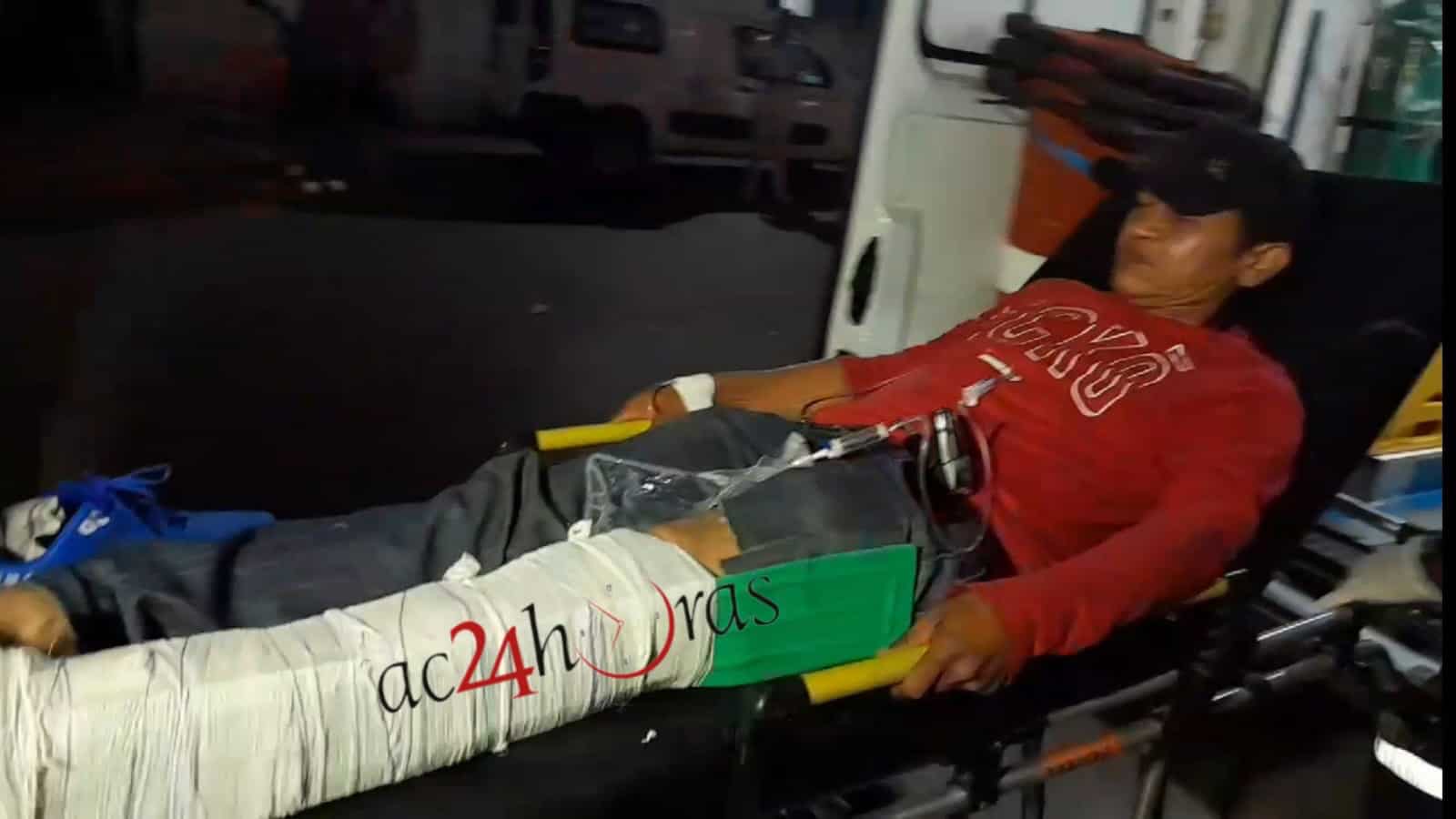 Homem é atropelado ao tentar fugir de agressores no Nova Esperança Homem é atropelado ao tentar fugir de agressores no Nova Esperança