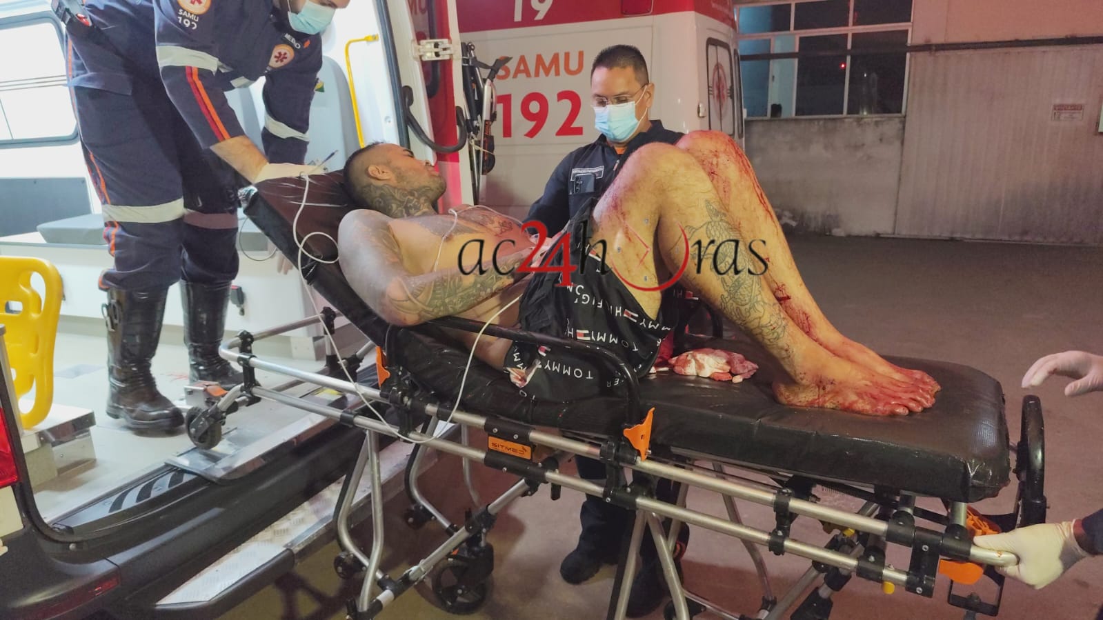 Discussão entre marido e mulher termina com um ferido a golpe de faca – ac24horas.com Discussão entre marido e mulher termina com um ferido a golpe de faca – ac24horas.com