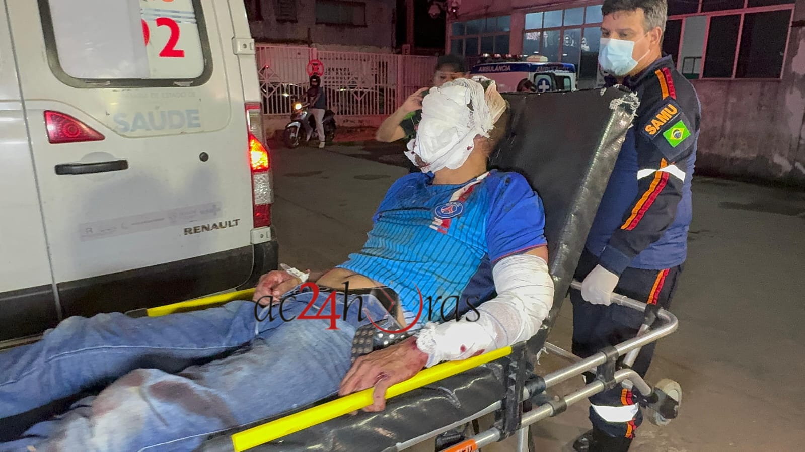 Acusado de ser informante da polícia é espancado por criminosos – ac24horas.com Acusado de ser informante da polícia é espancado por criminosos – ac24horas.com