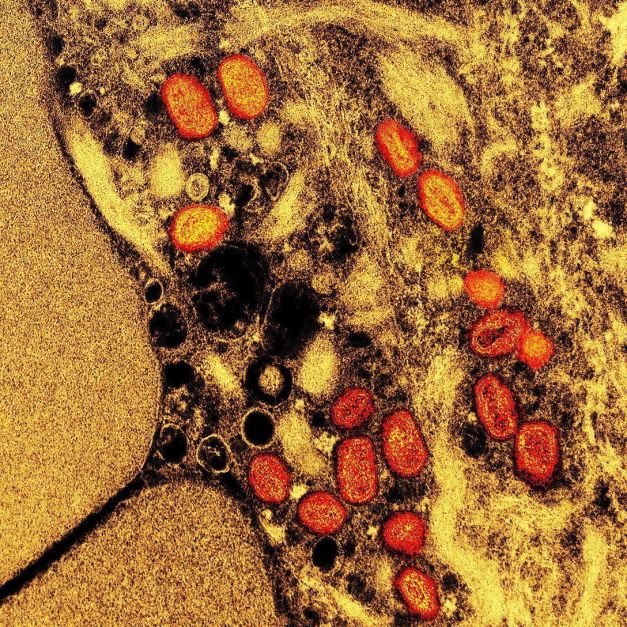 Mpox: Brasil registra 945 casos desde o começo do ano e ultrapassa marca de 2023 Mpox: Brasil registra 945 casos desde o começo do ano e ultrapassa marca de 2023