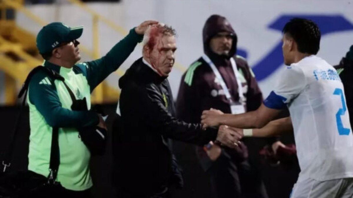 Treinador da seleção do México é agredido em Honduras Treinador da seleção do México é agredido em Honduras