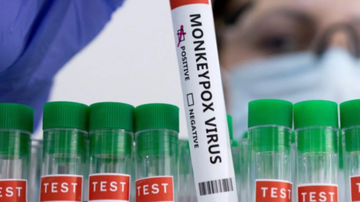 Brasil registra 1,5 mil casos de mpox em 2024 Brasil registra 1,5 mil casos de mpox em 2024