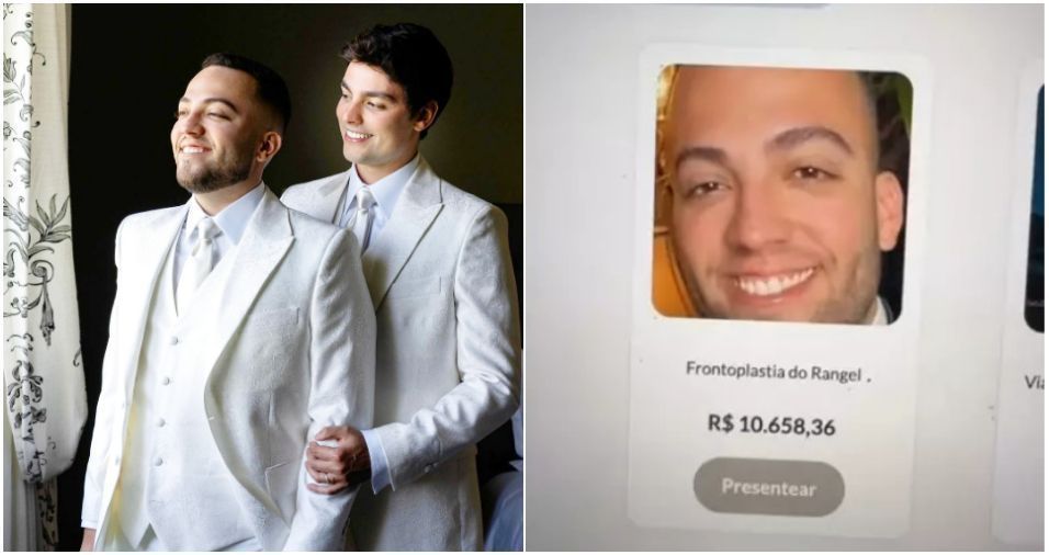 Lucas Rangel e Bley ganharam cirurgia de redução de testa de casamento? Entenda Lucas Rangel e Bley ganharam cirurgia de redução de testa de casamento? Entenda