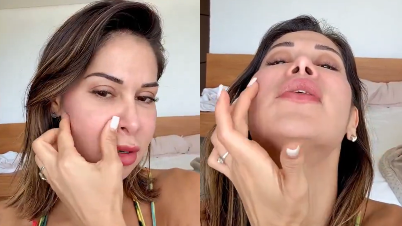 PMMA: o que é e por que é perigoso para saúde PMMA: o que é e por que é perigoso para saúde